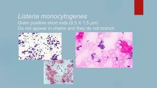Listeria monocytogenes
Gram positive short rods (0.5 X 1.5 µm)
Do not appear in chains and they do not branch.
 
