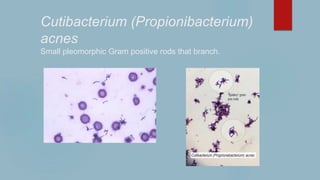 Cutibacterium (Propionibacterium)
acnes
Small pleomorphic Gram positive rods that branch.
 