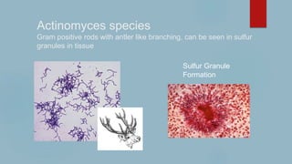 Actinomyces species
Gram positive rods with antler like branching, can be seen in sulfur
granules in tissue
Sulfur Granule
Formation
 