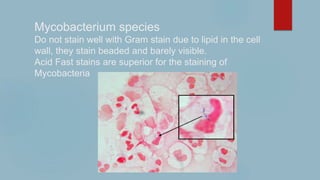 Mycobacterium species
Do not stain well with Gram stain due to lipid in the cell
wall, they stain beaded and barely visible.
Acid Fast stains are superior for the staining of
Mycobacteria
 