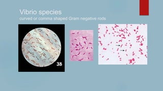 Vibrio species
curved or comma shaped Gram negative rods
 
