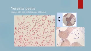 Yersinia pestis
Safety pin like with bipolar staining
---
 