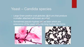Yeast – Candida species
 Large Gram positive oval globules (@ 8 um) that produce
a smaller attached cell known as a bud
 Sometimes pseudo-hyphae can be seen which are
extensions of the yeast cells into long hyphae like forms
 