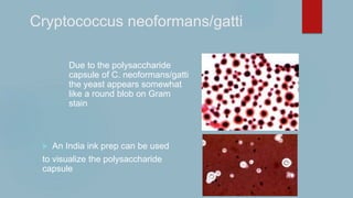 Cryptococcus neoformans/gatti
Due to the polysaccharide
capsule of C. neoformans/gatti
the yeast appears somewhat
like a round blob on Gram
stain
 An India ink prep can be used
to visualize the polysaccharide
capsule
 