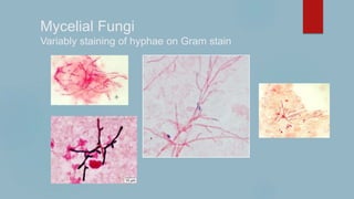 Mycelial Fungi
Variably staining of hyphae on Gram stain
 