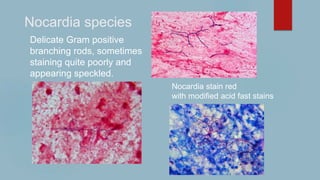 Nocardia species
Delicate Gram positive
branching rods, sometimes
staining quite poorly and
appearing speckled.
Nocardia s...