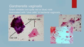 Gardnerella vaginalis
Gram variable (not quite red or blue) rods
Associated with “clue cells” in bacterial vaginosis
 