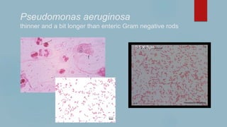 Pseudomonas aeruginosa
thinner and a bit longer than enteric Gram negative rods
0.5 X 3µm
 