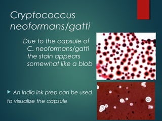 Cryptococcus
neoformans/gatti
Due to the capsule of
C. neoformans/gatti
the stain appears
somewhat like a blob
 An India ink prep can be used
to visualize the capsule
 