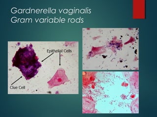 Gardnerella vaginalis
Gram variable rods
 