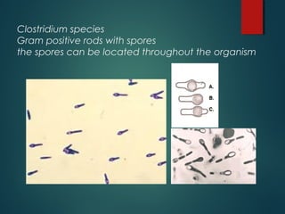 Clostridium species
Gram positive rods with spores
the spores can be located throughout the organism
 