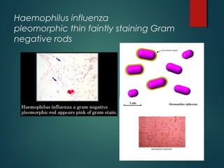 Haemophilus influenza
pleomorphic thin faintly staining Gram
negative rods
 