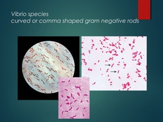 Vibrio species
curved or comma shaped gram negative rods
 