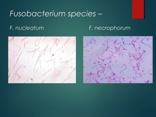 Fusobacterium species –
F. nucleatum F. necrophorum
 