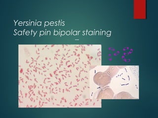 Yersinia pestis
Safety pin bipolar staining
---
 