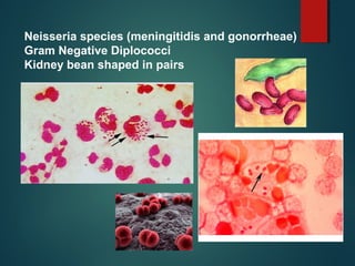 Neisseria species (meningitidis and gonorrheae)
Gram Negative Diplococci
Kidney bean shaped in pairs
 