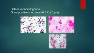 Listeria monocytogenes
Gram positive short rods (0.5 X 1.5 µm)
 