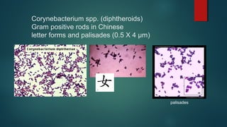 Corynebacterium spp. (diphtheroids)
Gram positive rods in Chinese
letter forms and palisades (0.5 X 4 µm)
palisades
 