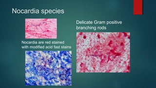 Nocardia species
Delicate Gram positive
branching rods
Nocardia are red stained
with modified acid fast stains
 