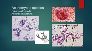 Actinomyces species
Gram positive rods
Antler like branching
Sulfur Granule Formation
 