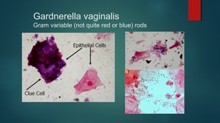 Gardnerella vaginalis
Gram variable (not quite red or blue) rods
 