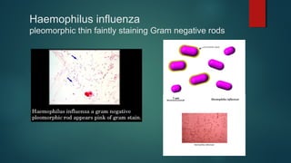 Haemophilus influenza
pleomorphic thin faintly staining Gram negative rods
 