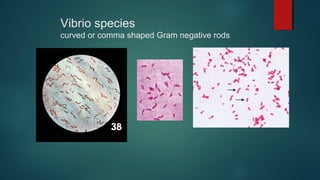 Vibrio species
curved or comma shaped Gram negative rods
 