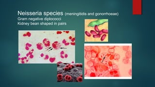 Neisseria species (meningitidis and gonorrhoeae)
Gram negative diplococci
Kidney bean shaped in pairs
 