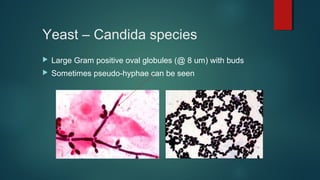 Yeast – Candida species
 Large Gram positive oval globules (@ 8 um) with buds
 Sometimes pseudo-hyphae can be seen
 