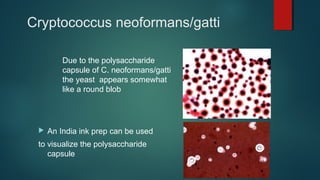 Cryptococcus neoformans/gatti
Due to the polysaccharide
capsule of C. neoformans/gatti
the yeast appears somewhat
like a round blob
 An India ink prep can be used
to visualize the polysaccharide
capsule
 