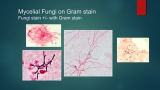 Mycelial Fungi on Gram stain
Fungi stain +/- with Gram stain
 