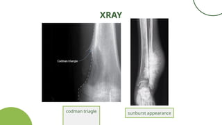 Grand Case Osteosarcoma 0000000000000000 | PPTX