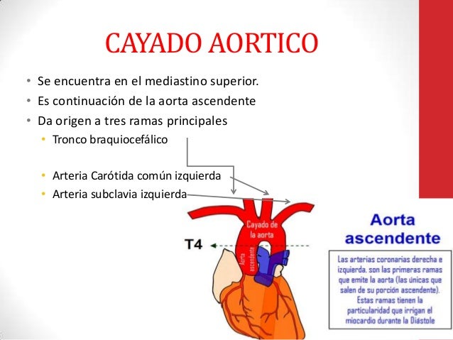 Qué Es El Cayado Aórtico _ Aneurisma aórtico: qué es, síntomas y ...