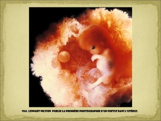 1965. Lennart Nilsson publie la première photographie d'un foetus dans l'utérus.
 
