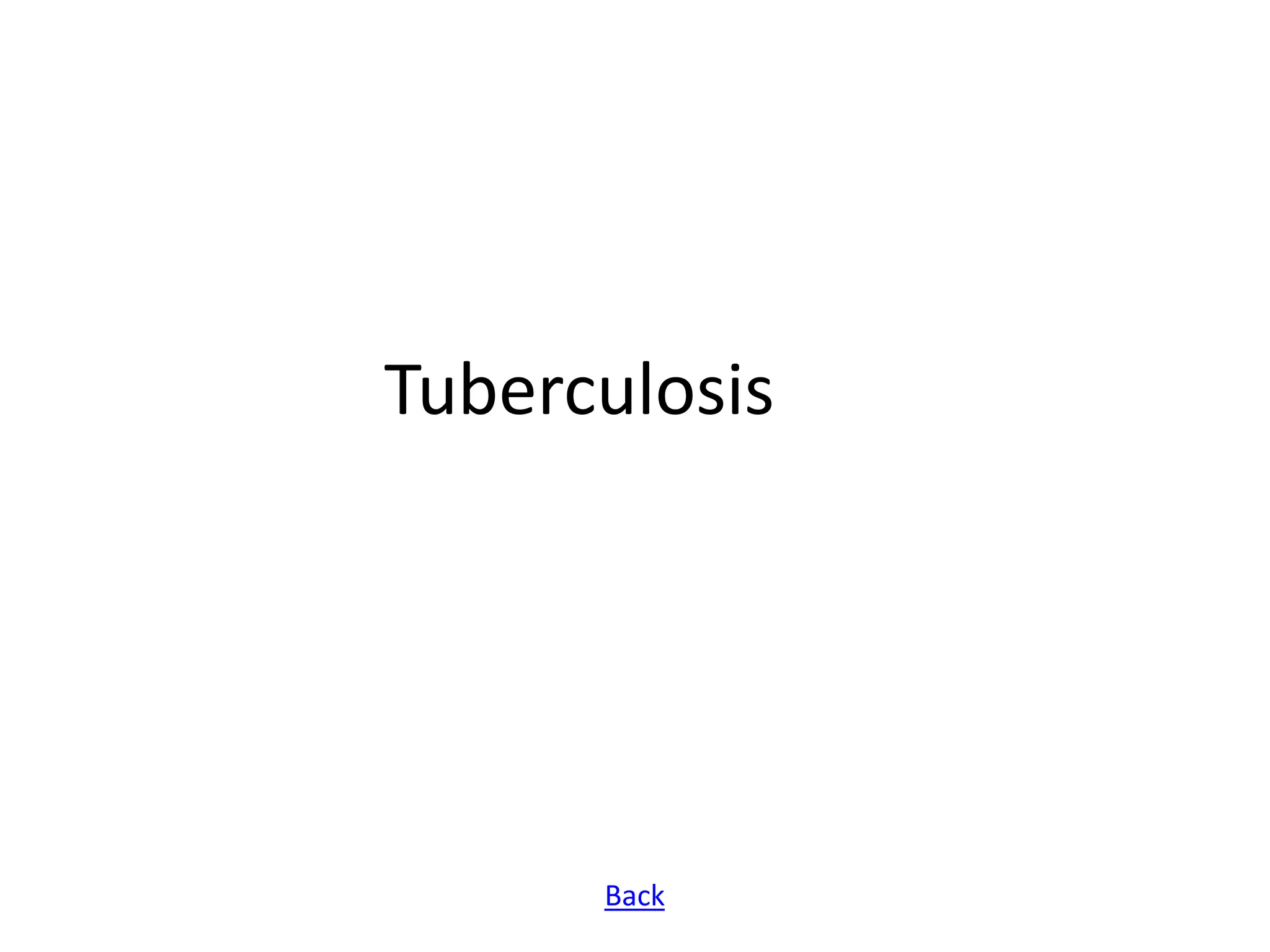 Tuberculosis




      Back
 