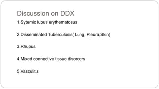 1.Sytemic lupus erythematosus
2.Disseminated Tuberculosis( Lung, Pleura,Skin)
3.Rhupus
4.Mixed connective tissue disorders
5.Vasculitis
Discussion on DDX
 