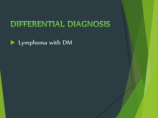  Lymphoma with DM
 