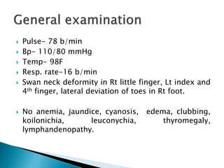  Pulse- 78 b/min
 Bp- 110/80 mmHg
 Temp- 98F
 Resp. rate-16 b/min
 Swan neck deformity in Rt little finger, Lt index and
4th finger, lateral deviation of toes in Rt foot.
 No anemia, jaundice, cyanosis, edema, clubbing,
koilonichia, leuconychia, thyromegaly,
lymphandenopathy.
 