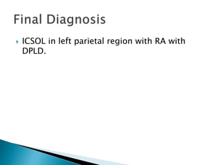  ICSOL in left parietal region with RA with
DPLD.
 