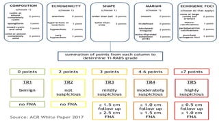 TIRAD Composition
Echogenecity
Shape
Margin
Echogenic foci
+ nodule
size
 