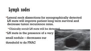 Lymph nodes
Lateral neck dissections for sonographically detected
LN mets will improve patient long term survival and
decrease tumor recurrence rates.
Clinically occult LN mets will be detected.
LN mets in the presence of a very
small nodule – decreases our
threshold to do FNAC
 