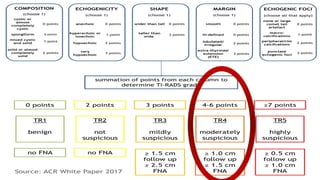 Our patient…..First ultrasound – 2016 (before TI-RAD)
Available info –
Echogenecity – hypoechoic - 2
Ecogenic foci – microcalcifications - 3
??Dimension – not clear.
TI-RAD score – atleast 5–
 Size – 3cm
TR4 – Moderately suspicious
Recc – U/S guided FNAC
 