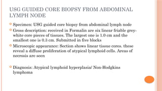 Complex Case Study: Abdominal Pain, Hypothyroidism, and Suspected ...