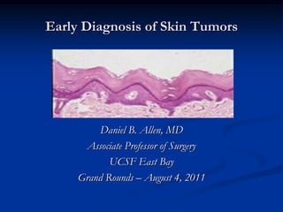 Early Diagnosis of Skin Tumors Daniel B. Allen, MD Associate Professor of Surgery UCSF East Bay Grand Rounds – August 4, 2011 