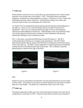 Case Report and Clinical Findings of Central Serous Retinopathy | PDF