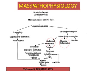 MAS:PATHOPHYSIOLOGY
Vidysagar D. PEDIATRICS 1975
 