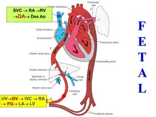 UVDV  IVC  RA
 FO LA LV
SVC  RA RV
DA Des Ao
F
E
T
A
L
 