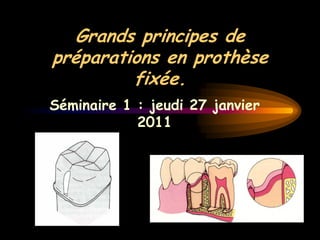 Grands principes de
préparations en prothèse
fixée.
Séminaire 1 : jeudi 27 janvier
2011
 