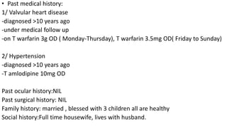 • Past medical history:
1/ Valvular heart disease
-diagnosed >10 years ago
-under medical follow up
-on T warfarin 3g OD ( Monday-Thursday), T warfarin 3.5mg OD( Friday to Sunday)
2/ Hypertension
-diagnosed >10 years ago
-T amlodipine 10mg OD
Past ocular history:NIL
Past surgical history: NIL
Family history: married , blessed with 3 children all are healthy
Social history:Full time housewife, lives with husband.
 