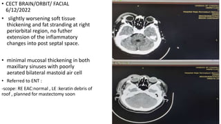 • CECT BRAIN/ORBIT/ FACIAL
6/12/2022
• slightly worsening soft tissue
thickening and fat stranding at right
periorbital region, no futher
extension of the inflammatory
changes into post septal space.
• minimal mucosal thickening in both
maxillary sinuses with poorly
aerated bilateral mastoid air cell
• Referred to ENT :
-scope: RE EAC:normal , LE :keratin debris of
roof , planned for mastectomy soon
 